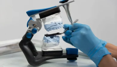 Custom-dental-prosthetics